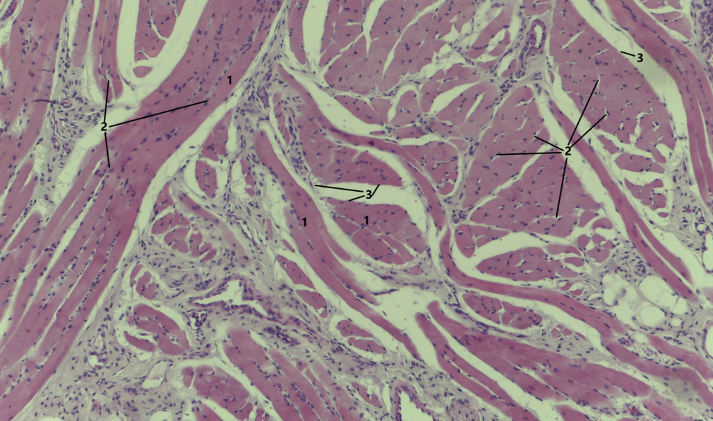 Tecido Muscular Atlas De Histologia Da Medicina