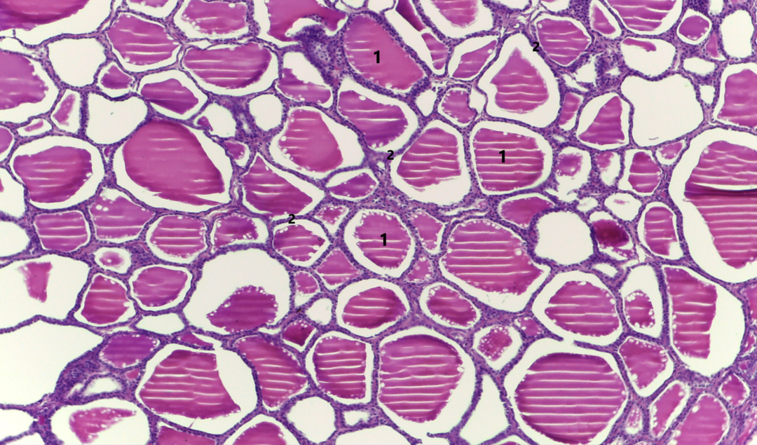 Epitélio Glandular Endócrino Atlas de Histologia da Medicina