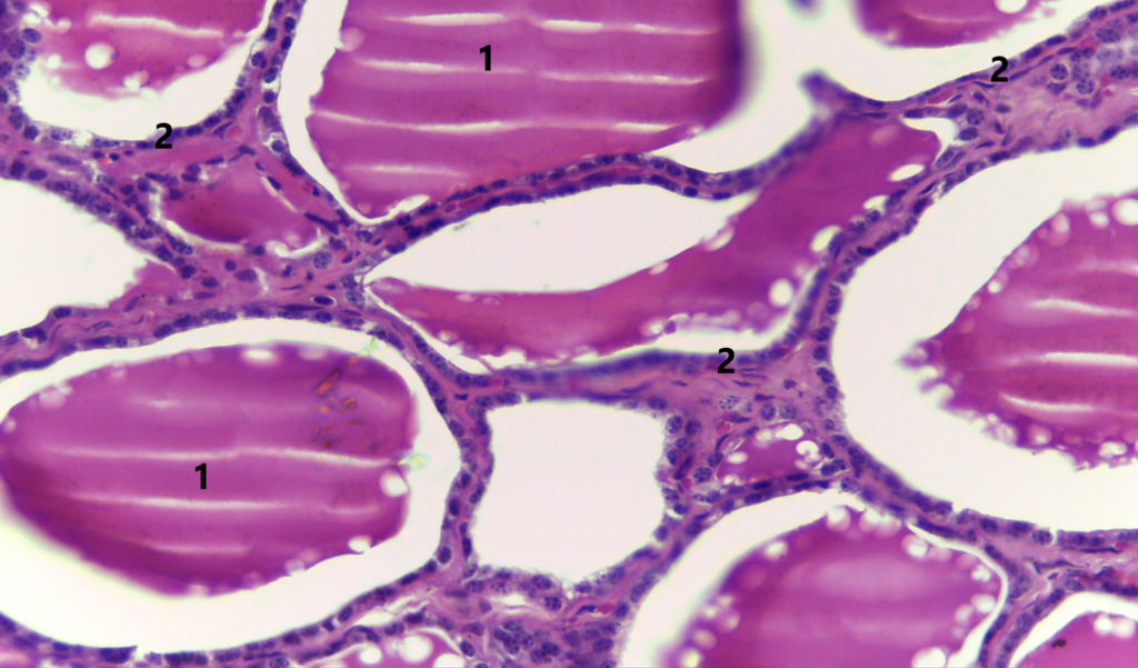 Epitélio Glandular Endócrino Atlas De Histologia Da Medicina